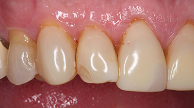 before after photo