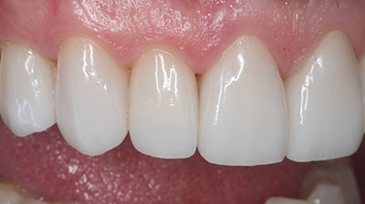 before after photo