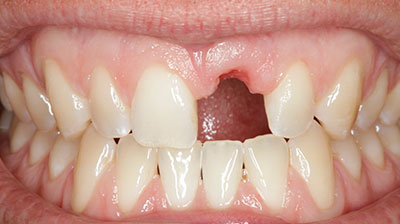 before after photo