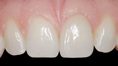 before after photo