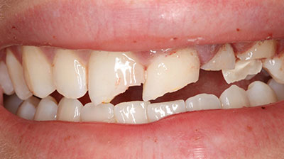 before after photo