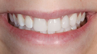 before after photo